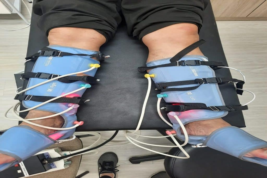 lipedema 2