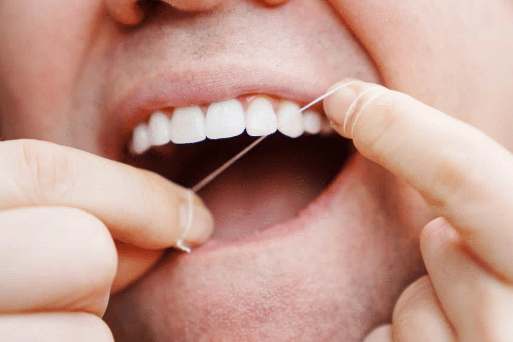 fio dental