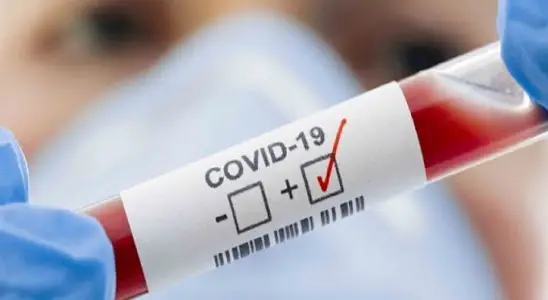 Covid-19 tem 12 casos positivos em agosto em São Carlos 6 covid